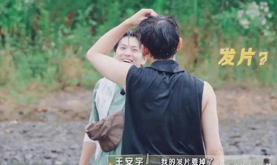 王安宇年纪轻轻就用假发片了吗？ ​​​