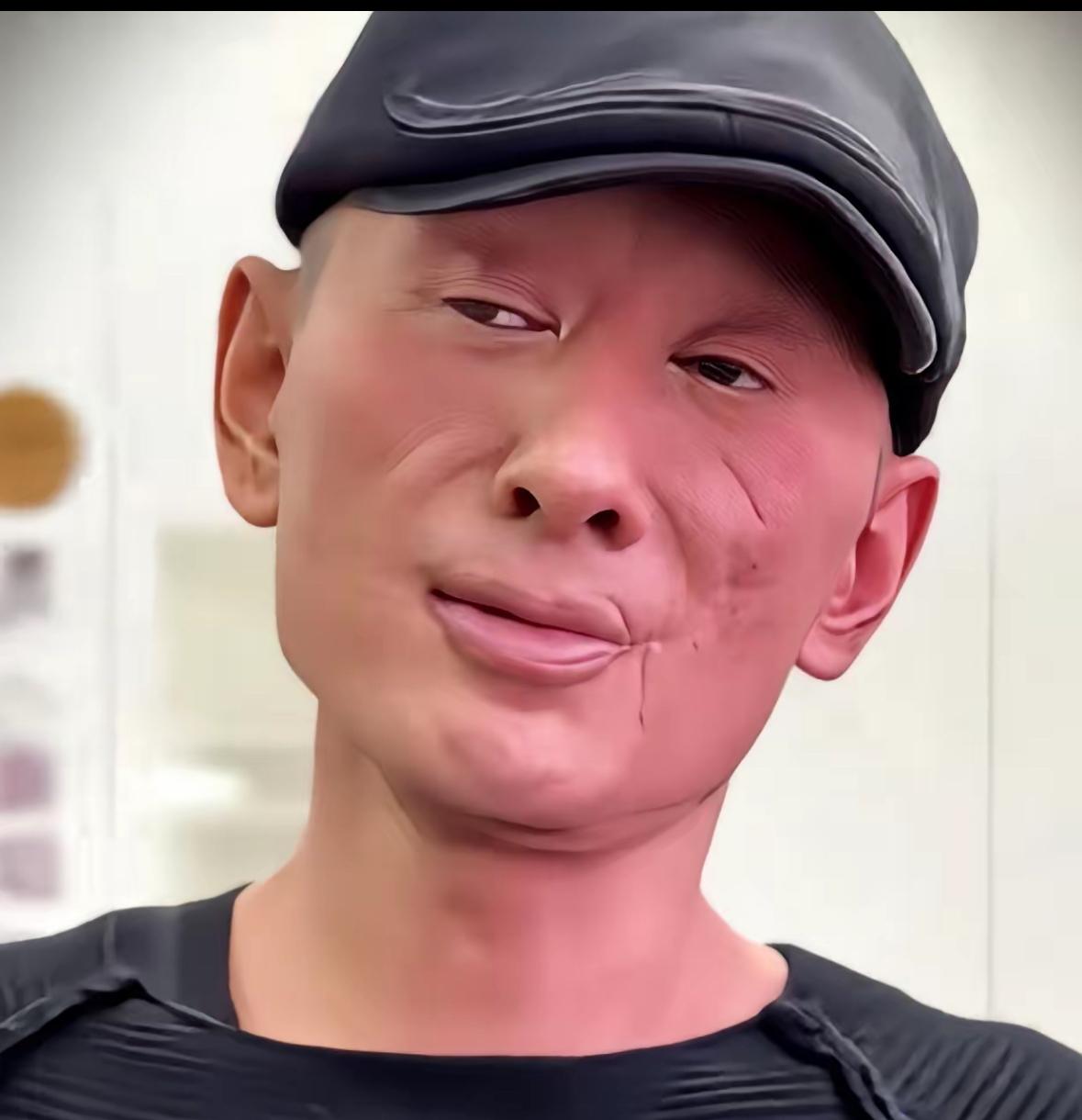 歌手阿宝如今的现状，
大家看到他，还能认出来吗，自从整容失败后，阿宝就淡出人们视
