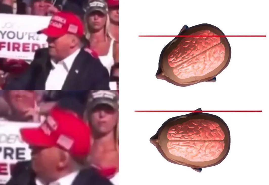 从图片可以看出，特朗普真的是很幸运，躲过了一劫。这一枪还是挺准的，如果不是特朗普