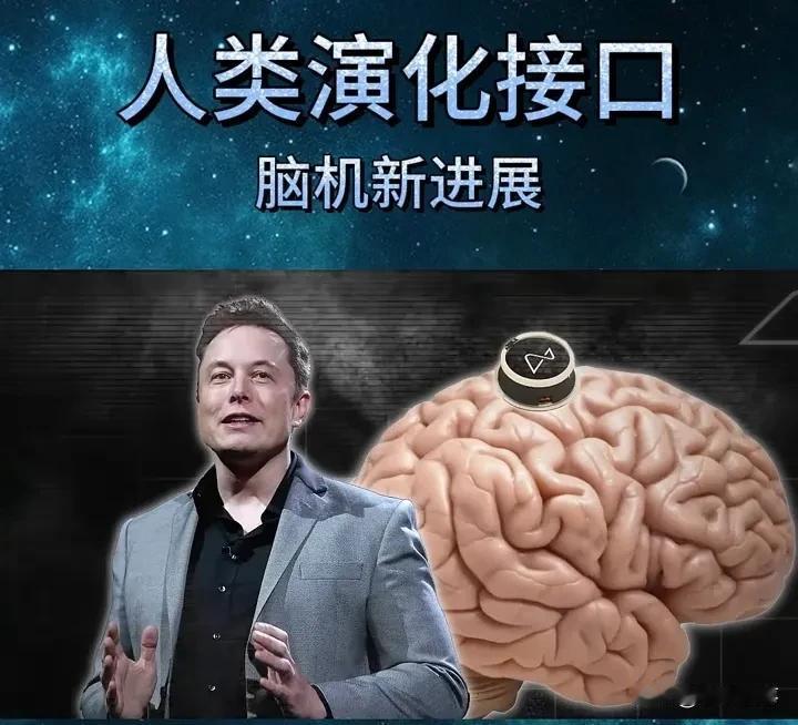 马斯克脑机接口炸锅！10分钟"成神"，你敢当第一个吃螃蟹的人吗？
 
2025年