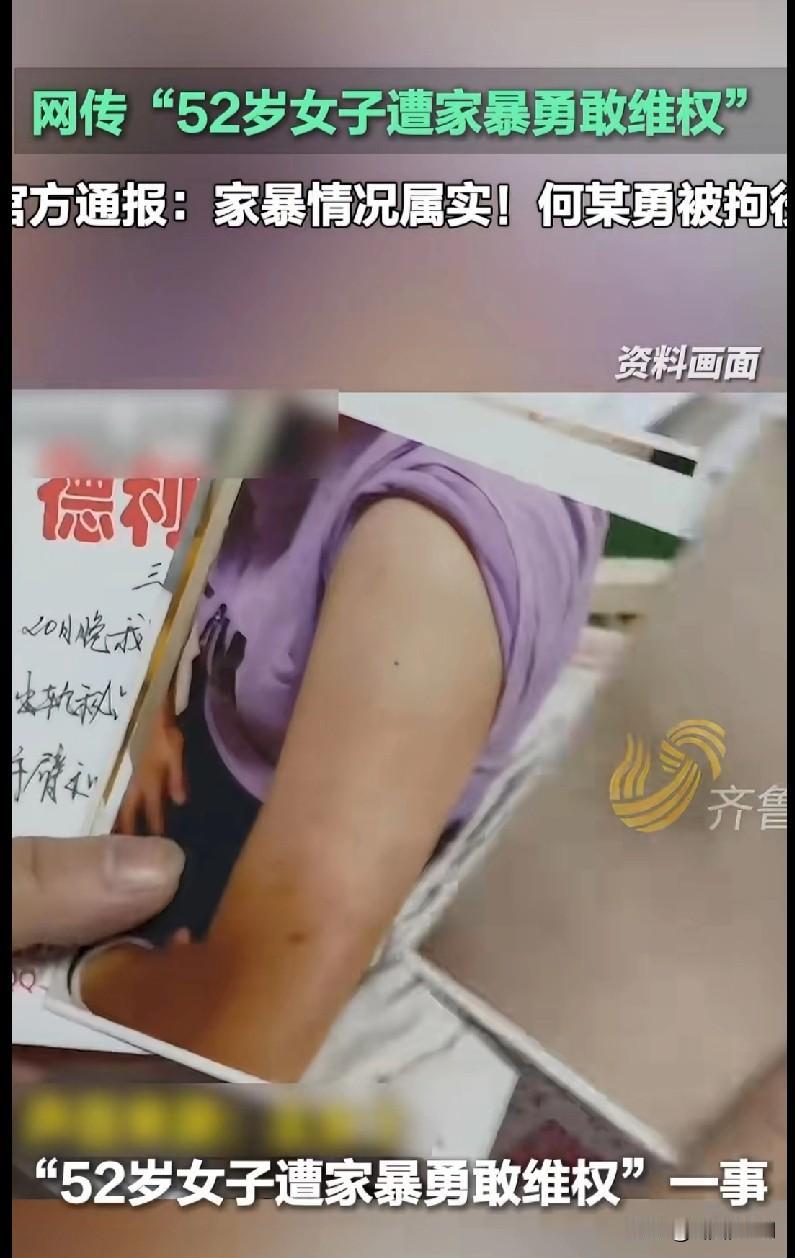 52岁阿姨遭家暴后硬刚，官方通报：施暴者被拘！
 
刚刷到这个新闻，拳头直接攥紧