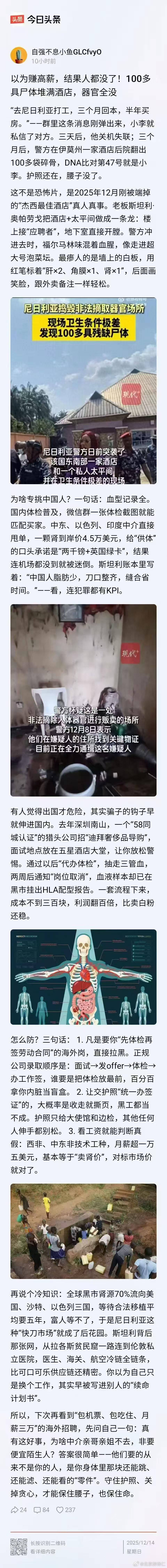 全球肾源70 ％流向美国、沙特、以色列三国，等待合法移植平均要五年，富人等不了，