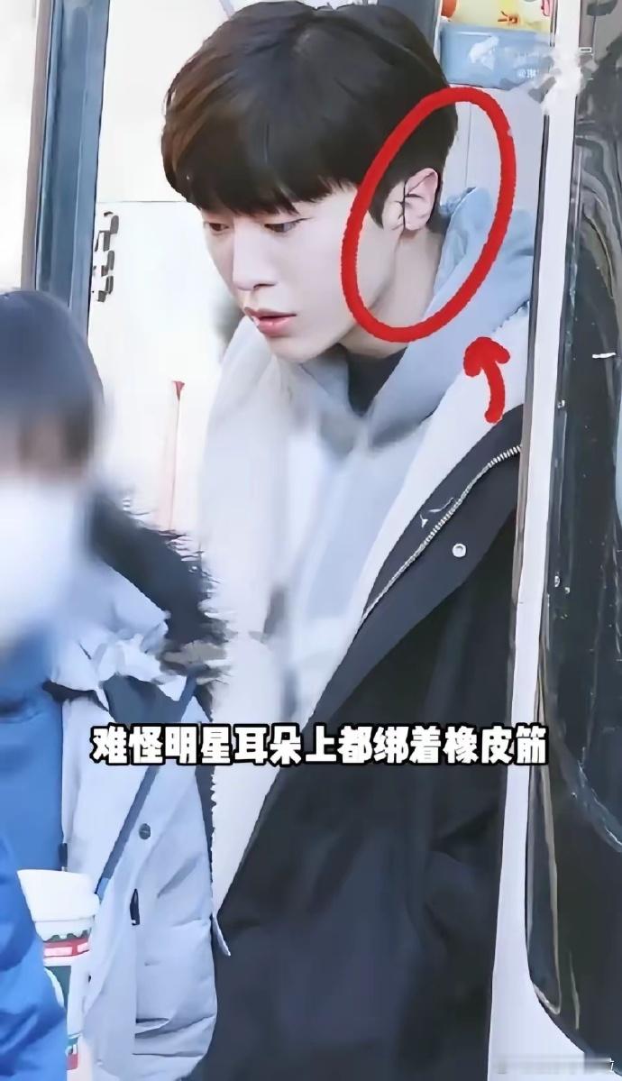 为何明星耳畔常系橡皮筋？ 