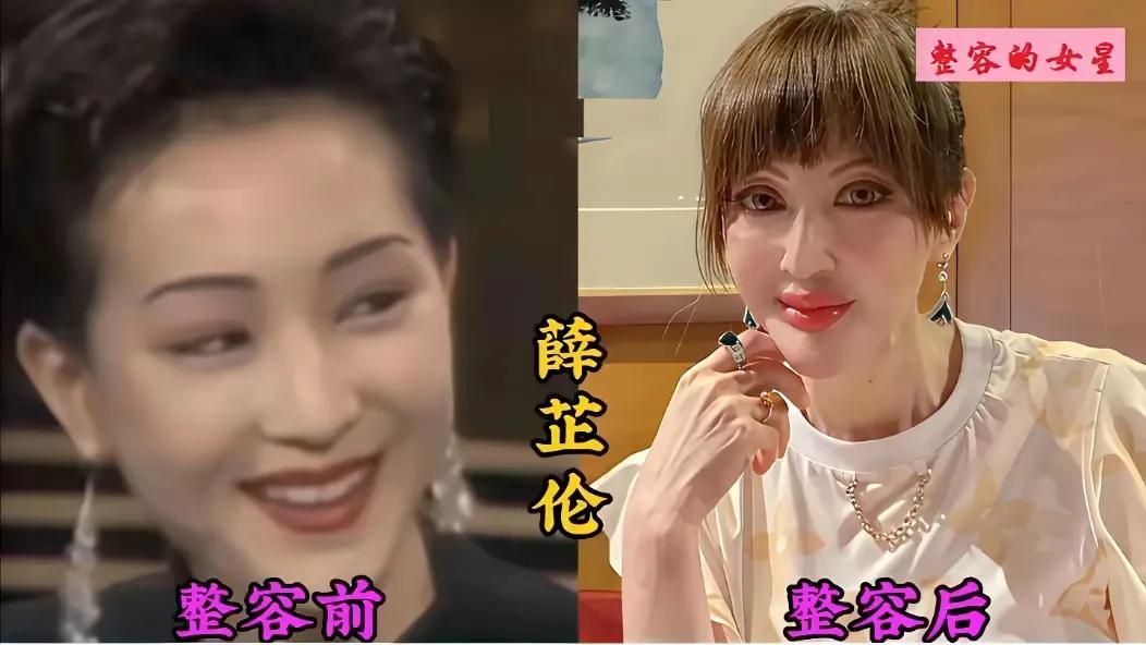 年轻时个个貌美如花，天生一副好模样。一心想要更美，过度折腾脸蛋，前后对比判若两人