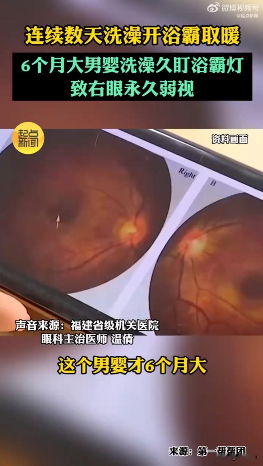 福建一位宝妈的经历真的给所有带娃家庭敲响了警钟，就因为一个无心之举，让6个月大的