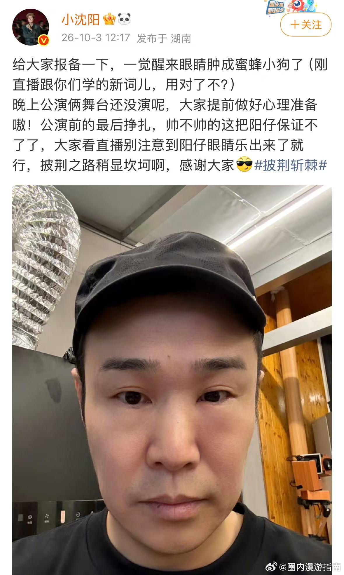 小沈阳一觉醒来天塌了小沈阳肿成蜜蜂小狗了小沈阳一觉醒来天塌了，小沈阳肿成蜜蜂小狗