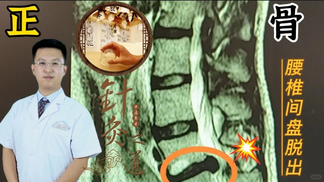 腰椎间盘突出该保守还是手术治疗？