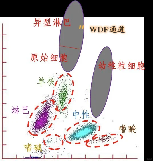 常见血常规直方图