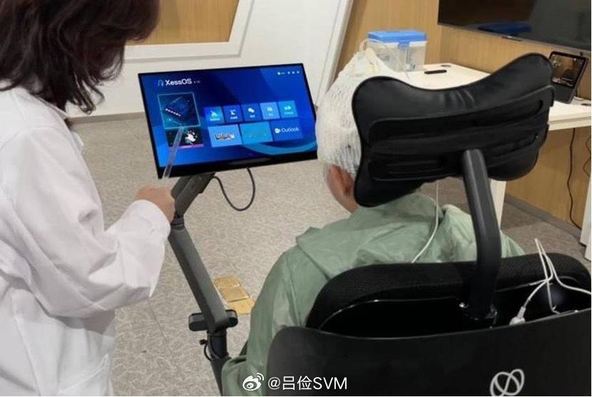 吕俭的汽车科普圈 今天聊聊汽车疲劳监测方式。过去最常见的疲劳监测方式有两种，一种