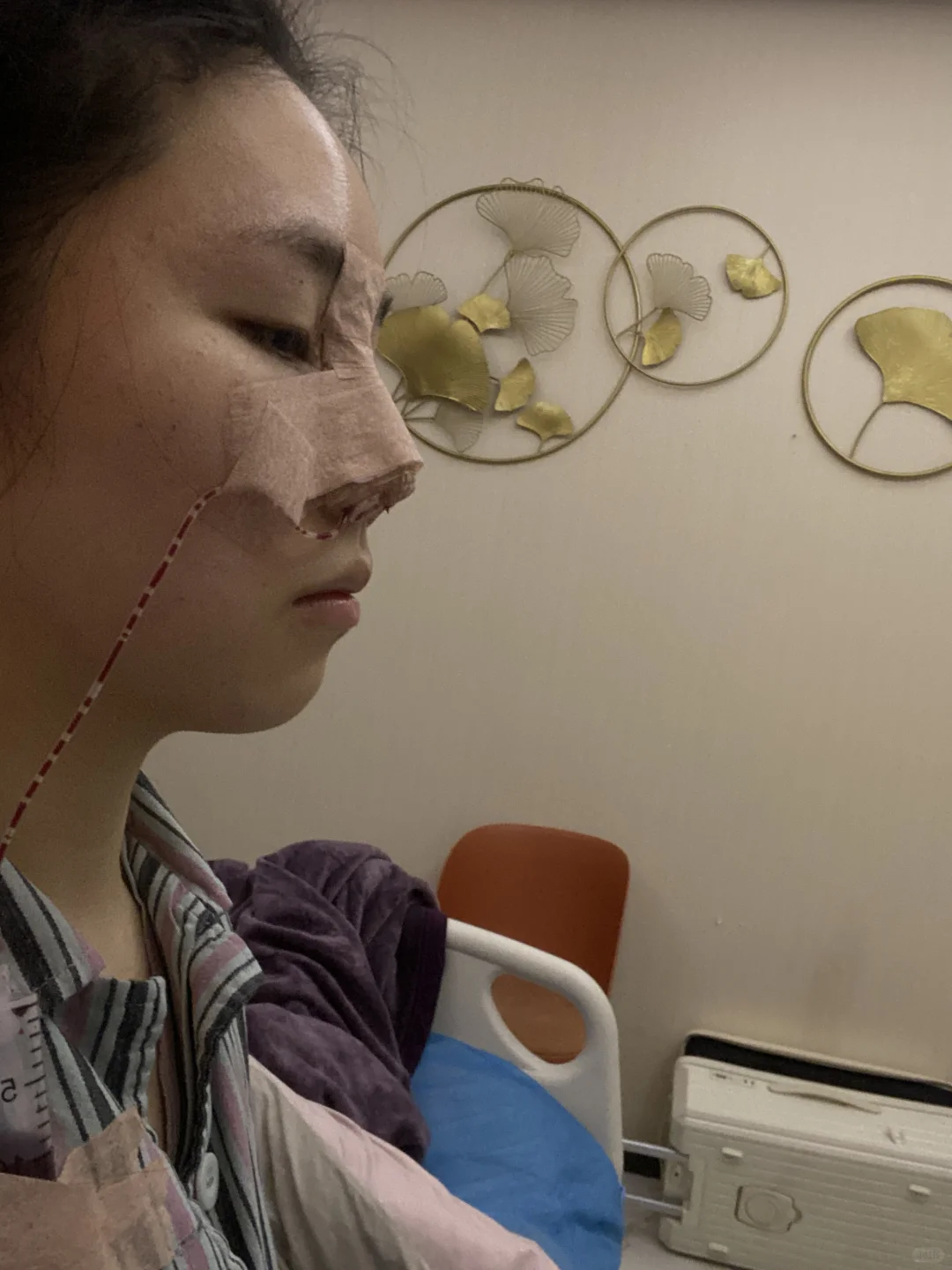 心心念念，终于把鼻子做啦 第一天