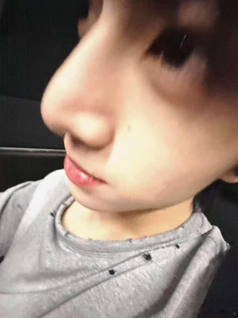 张康乐蚊子视角张康乐live张康乐live，蚊子视角，[傻眼][傻眼] ​​​