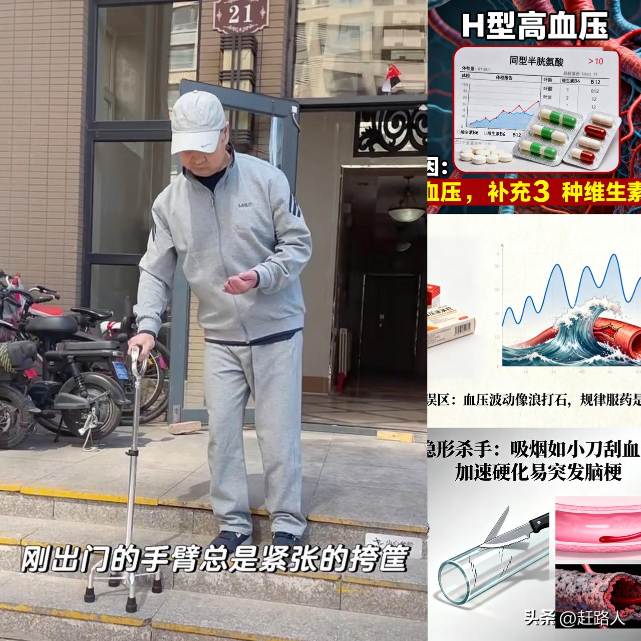 为什么中国人脑梗人那么多？尤其是中国农村的更多。医生总结3个关键原因
 
常有人