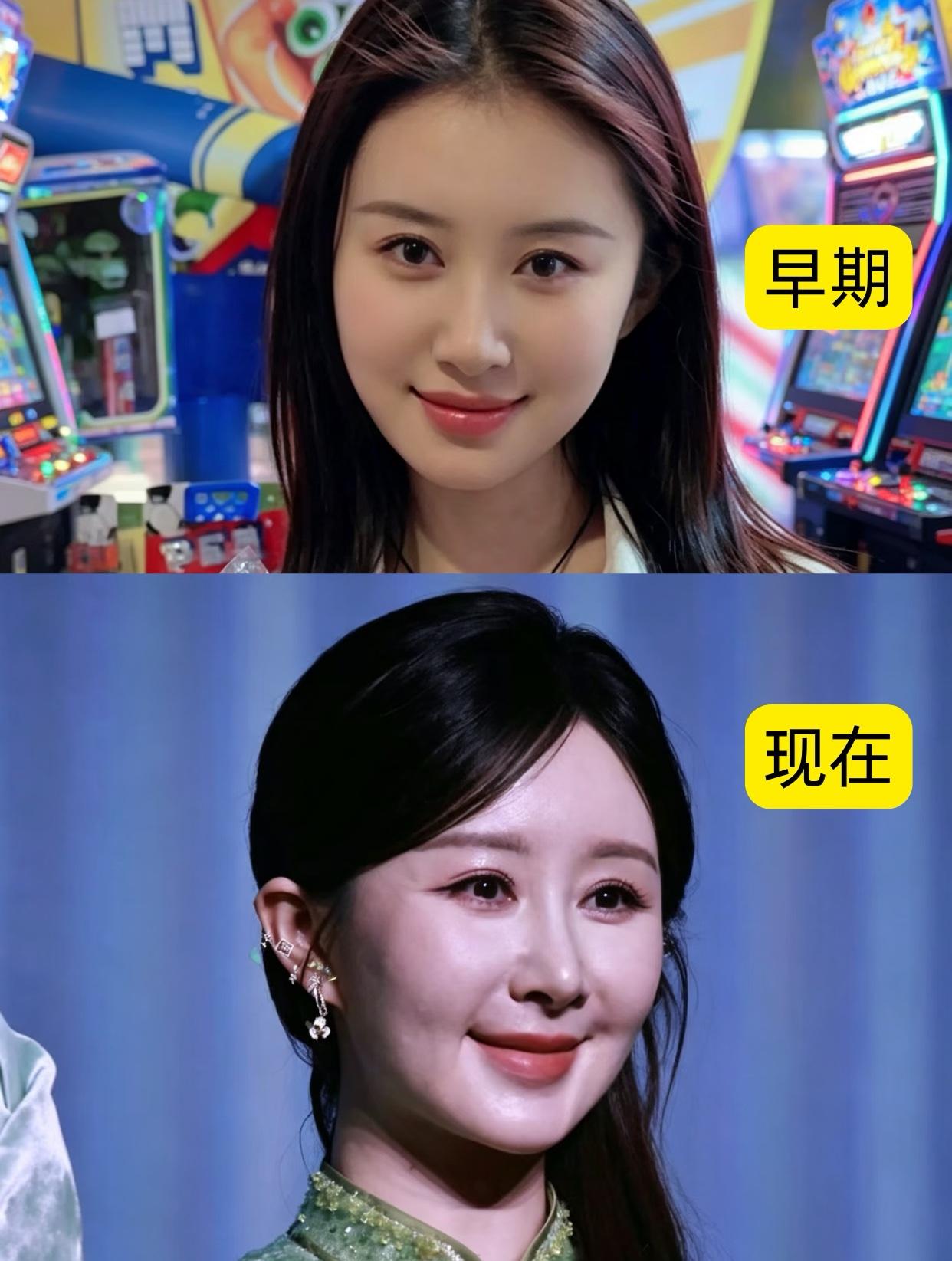 这真的太明显了，
但这次想说的是突然理解了女明星整容，
女为悦己者容，
更何况这
