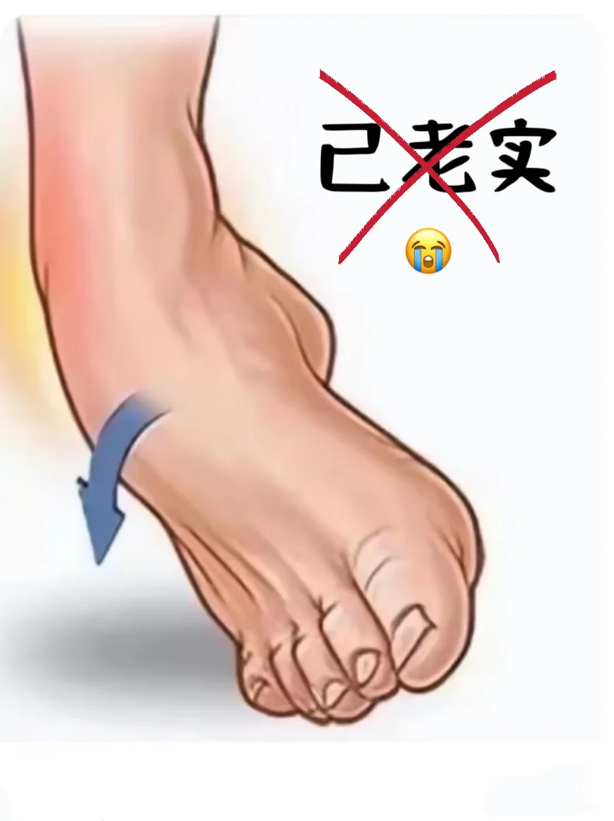 脚歪第一时间冰敷？还是喷药？