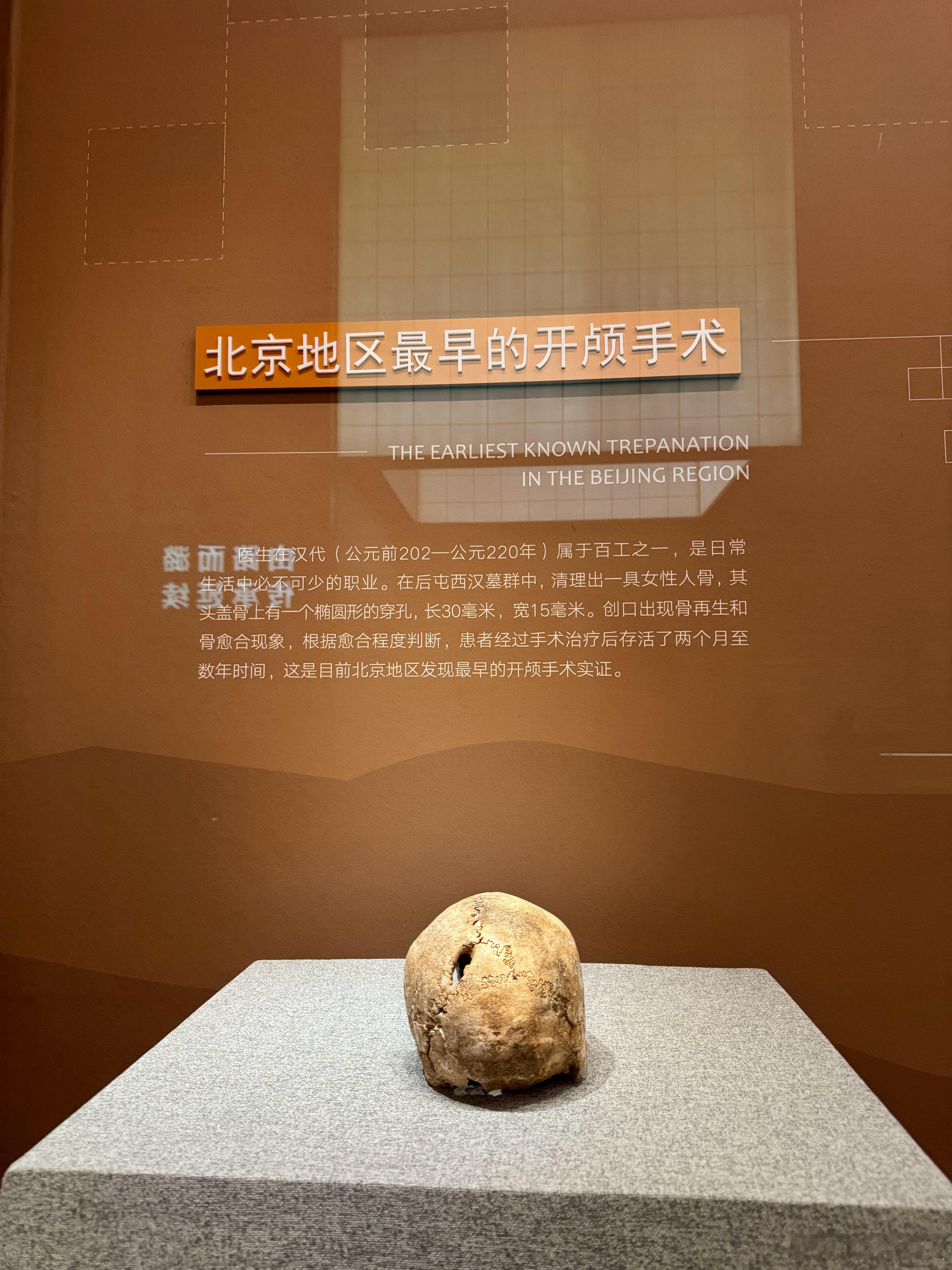 我的2025博物馆之旅这个有点厉害，汉代的开颅手术，伤口还有愈合的痕迹，也就是说