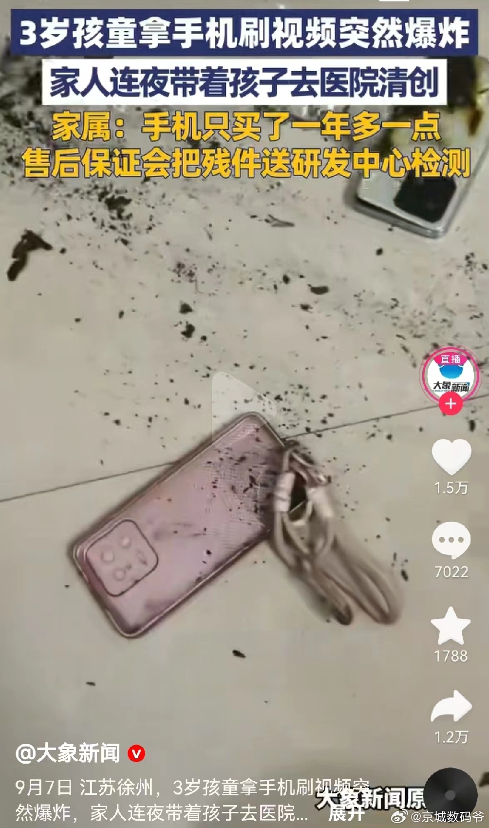 某品牌手机突然爆炸导致岁男童身体多处被烧伤！孩子手部和下肢目部位目前不同程度受伤