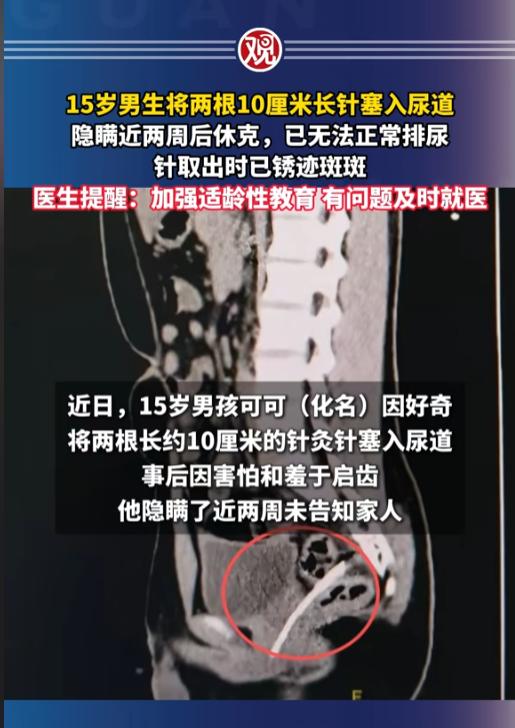 “适龄性教育真的得跟上！”7月1日报道，江苏，一位15岁的男生出于好奇，把两根1