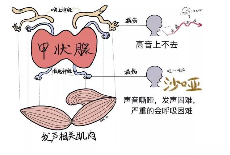 导致甲状腺癌的5个祸首已被揪出，早知道早受益！①如果直系亲属里，有患有甲状腺癌，