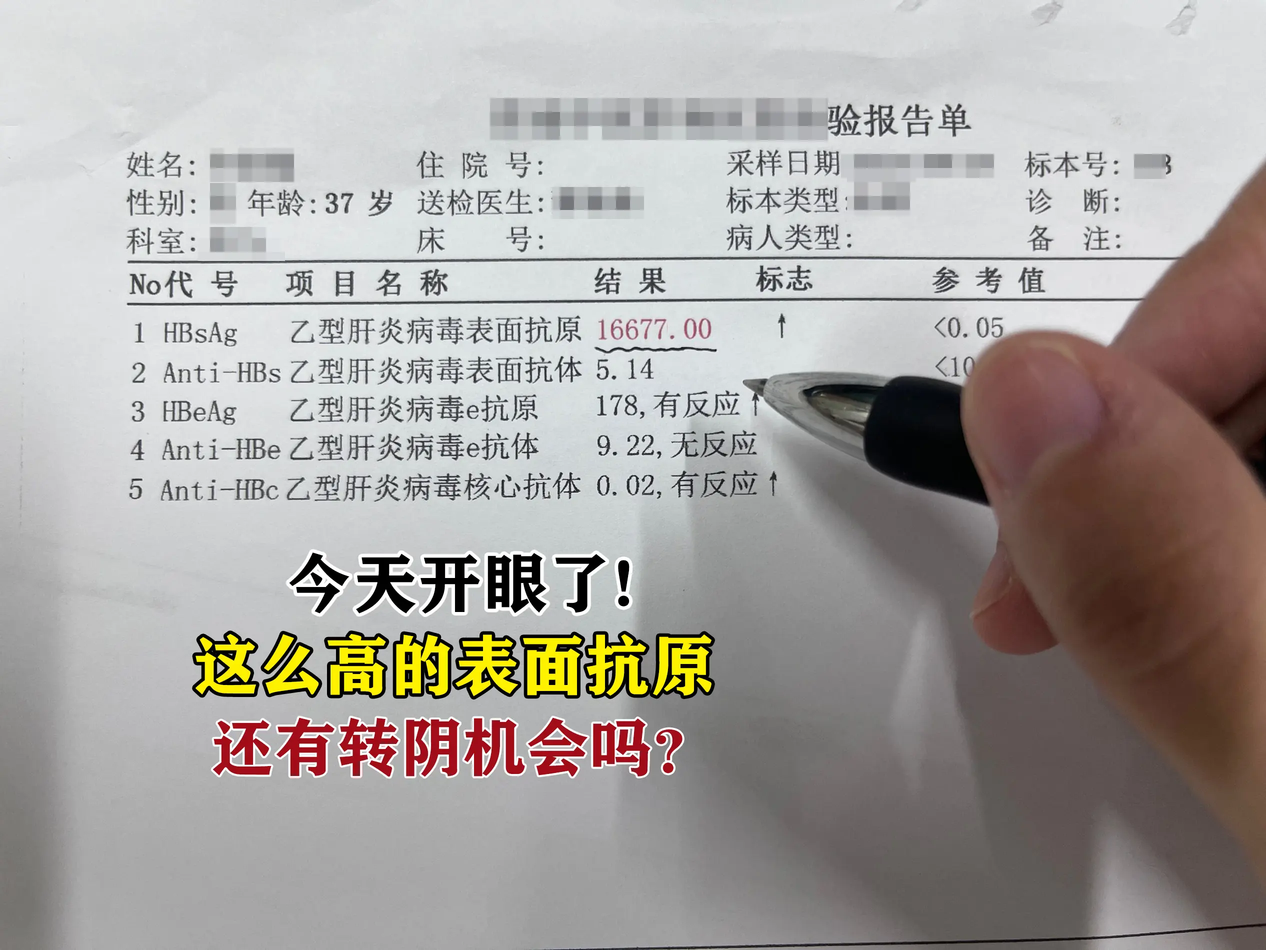 你这个表面抗原确实比较高。高表面抗原常见于这几种情况：一是病毒复制活跃...