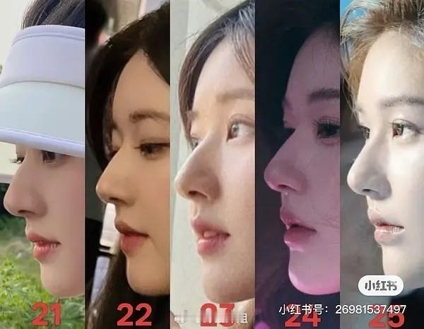 赵露思明确答复没有整容，很明确的说：没有整容！她说每次有人说她整容很开心，因为代