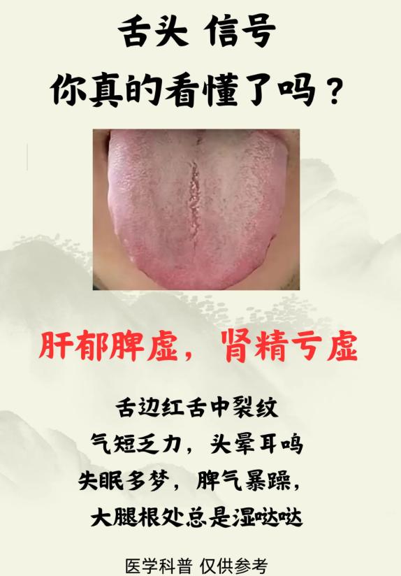 3 种舌象信号，看懂身体脏腑问题