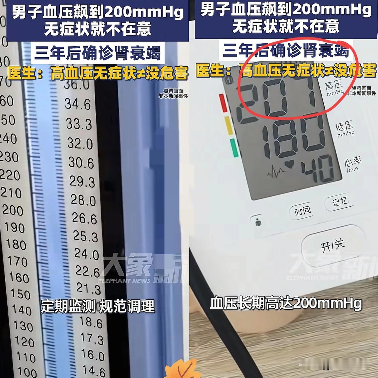 河南郑州，一男子血压长期高达200mmhg，却因为没有任何不适症状，所以一直没管