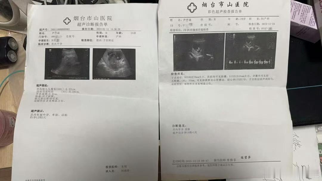 不是，现在还可以这样子吗？已婚已育女子网购怀孕B超单骗婚