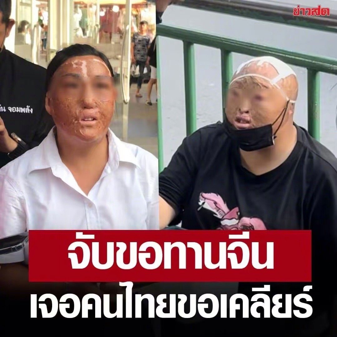 #曼谷街头现多名中国籍毁容乞讨者#想起了消失的她中的人彘 ​​​