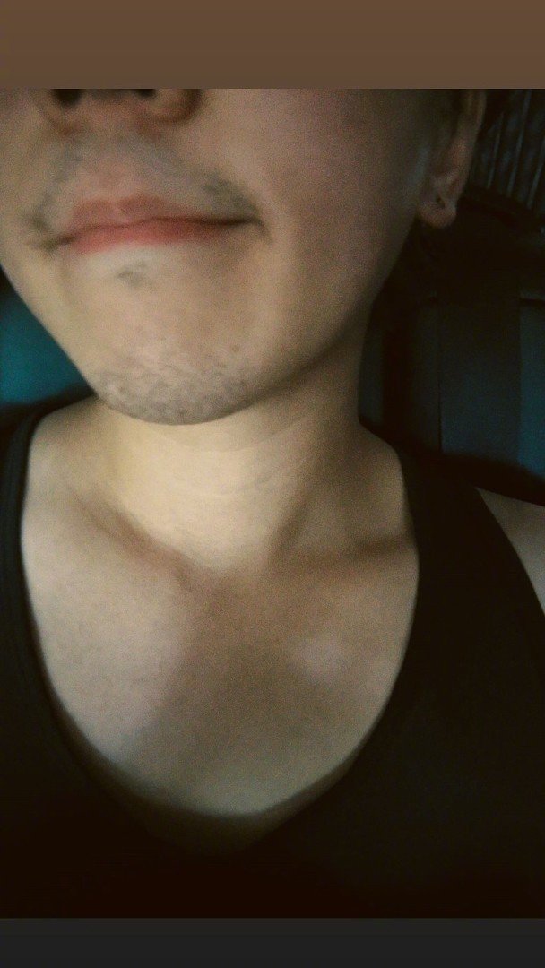 姜涛晒瘦身成果姜涛下巴尖V近日，姜涛晒半脸自拍，照片中下巴尖了不少，看起来健身很