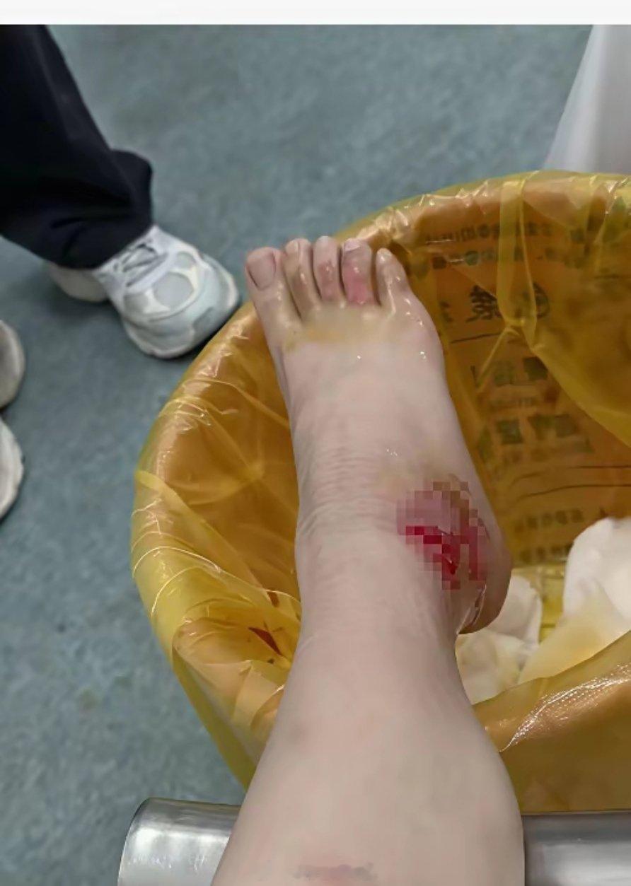 深圳这桩“接吻摔倒打翻火锅”的事，有点无奈。🍲起因是一对情侣在火锅店后排接吻，