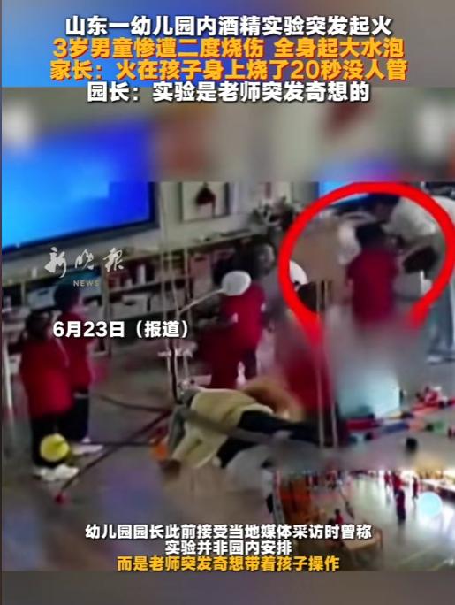 心都揪碎了！山东3岁男童幼儿园遭意外大火灼伤，身上着火20秒无人施救，满身水泡确