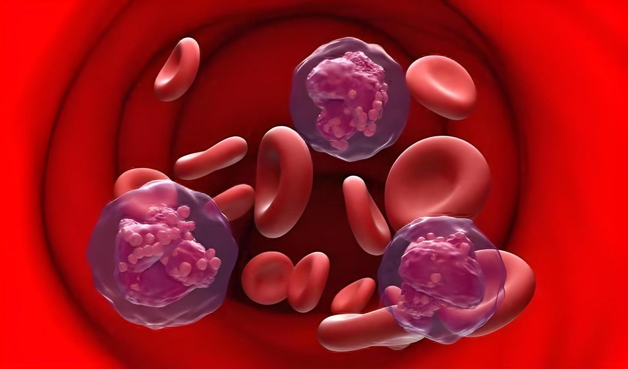 身上突然青一块紫一块是怎么回事？

身上突然青一块紫一块考虑与外伤、过敏性紫癜、