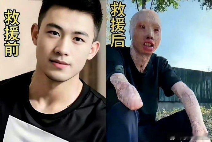 救火英雄救援前与救援后。看哭了[泪]这就是人民英雄，致敬！！！[good]  