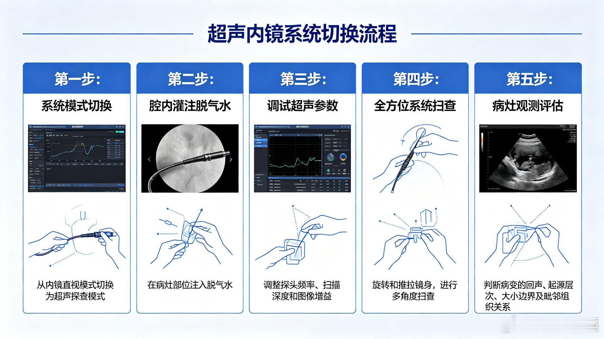 超声内镜操作流程1. 系统模式切换内镜直视模式切换为超声探查模式，接通超声成像系