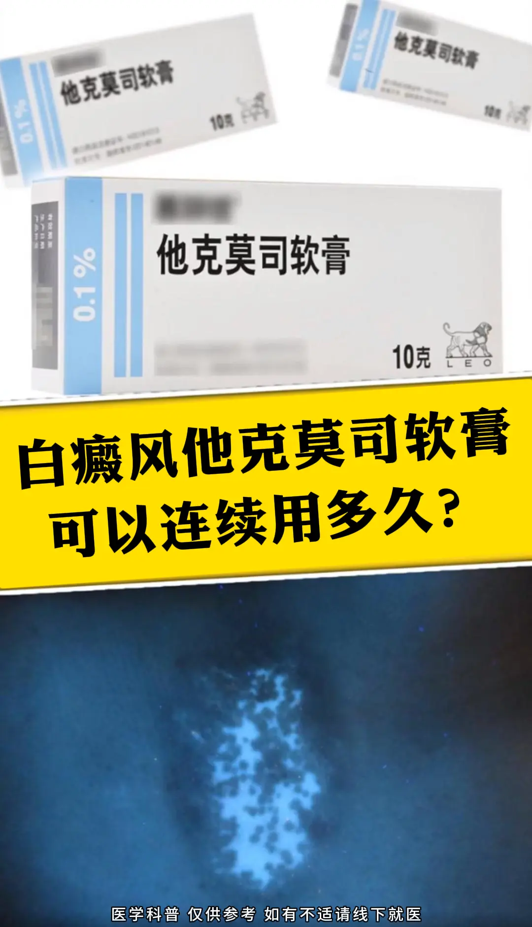 他克莫司用于白癜风治疗时，连续使用时间尚无绝对标准，通常可先连续用 3...