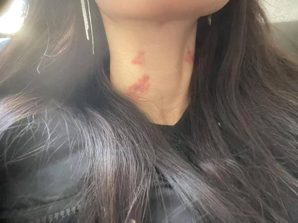 如何是好