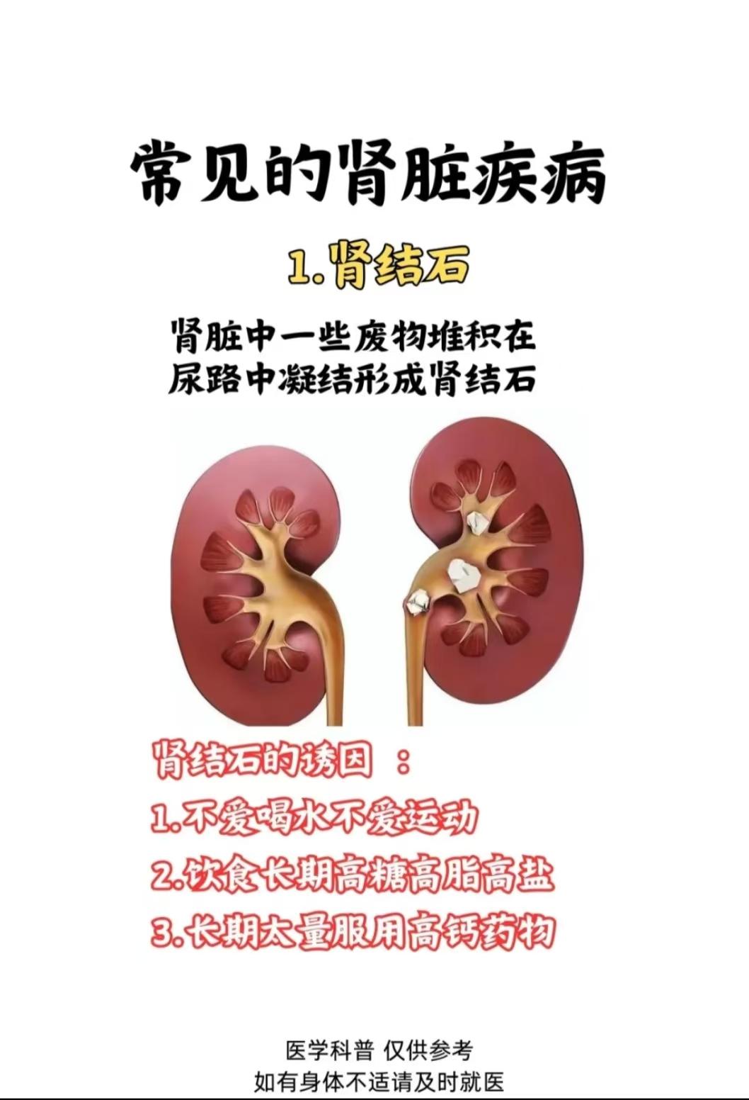 常见的五种肾脏疾病