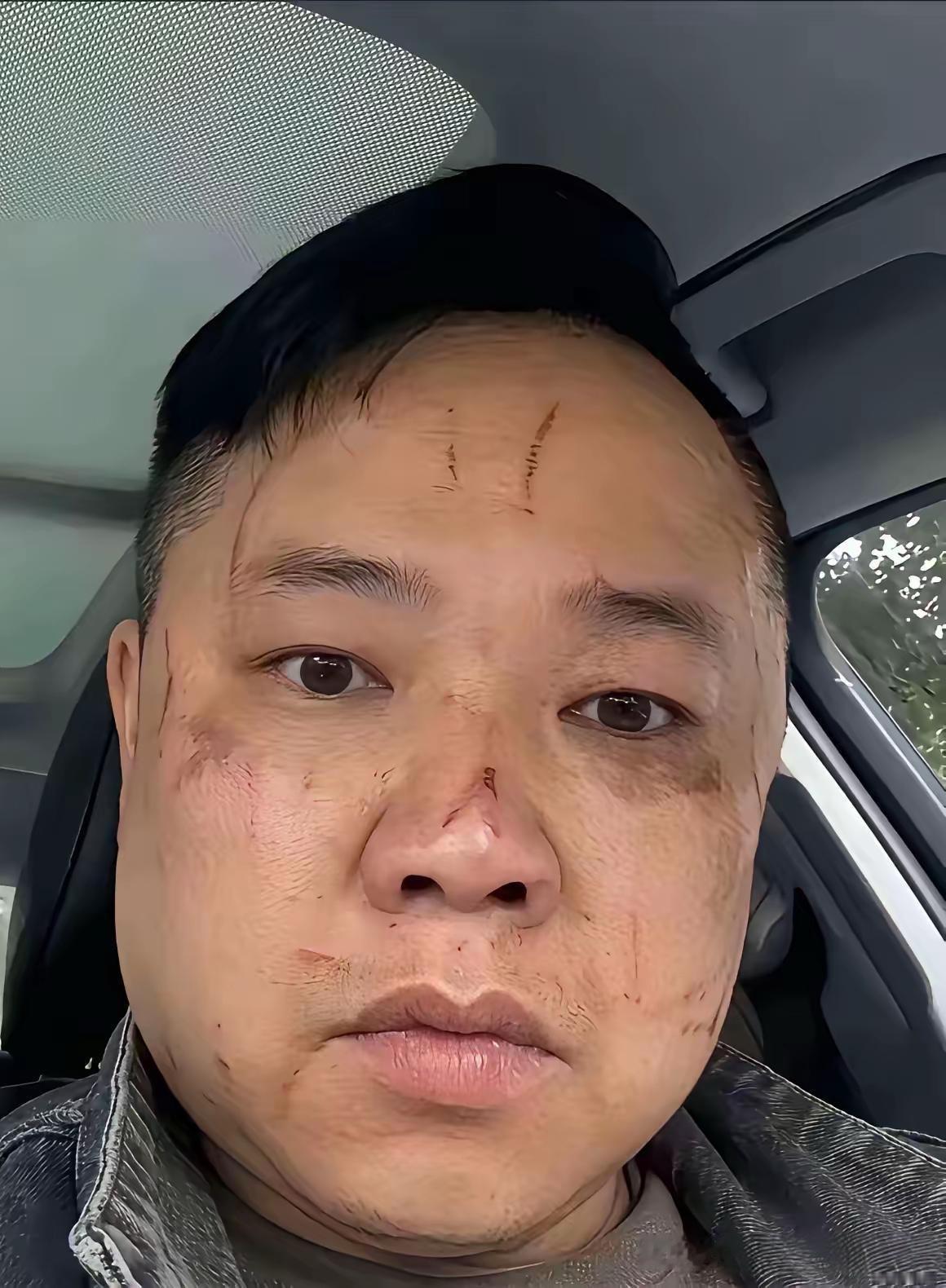 打仗不打脸不知道吗