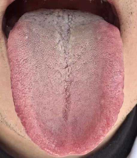 房事从容，离不开稳固的精门与健康的海绵体





有不少朋友到了中年就出现了功