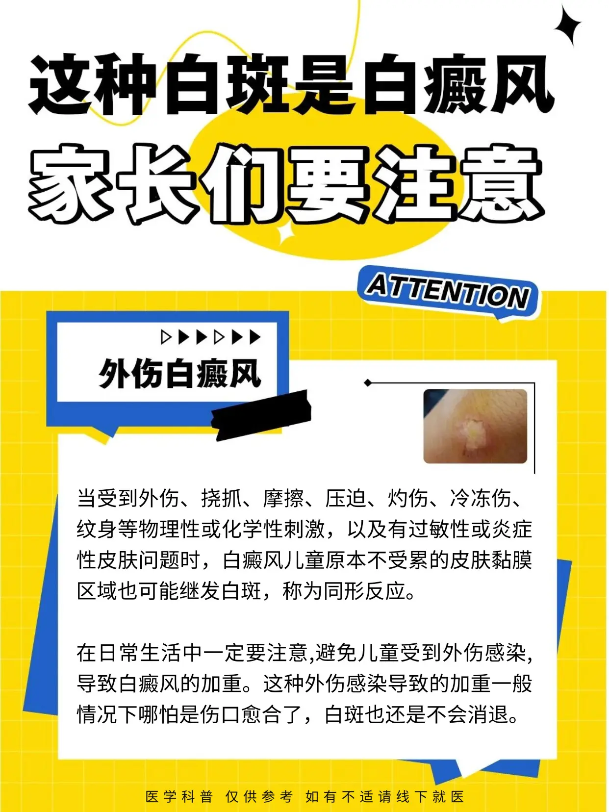 医学科普 白癜风 白癜风科普 硬核健康科普行动 医疗健康创作者训练营