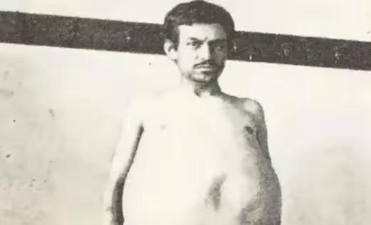 1940年，一位美国男子正在排泄大便时突然死亡，当法医检查过后发现男子体内竟然堆
