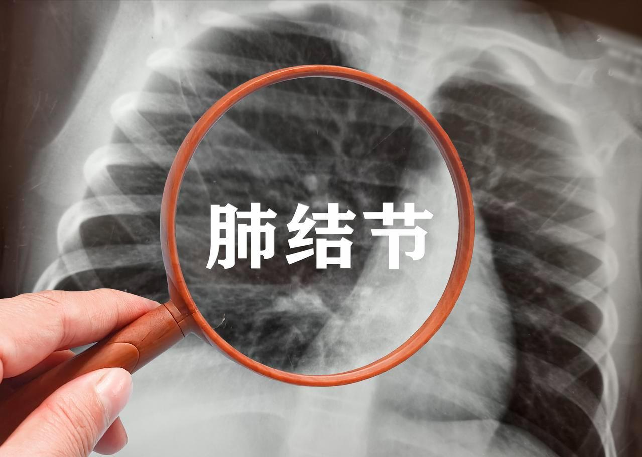 7mm磨玻璃结节，击碎一位母亲的心。“直径7mm的纯磨玻璃结节是恶性吗？”这是前