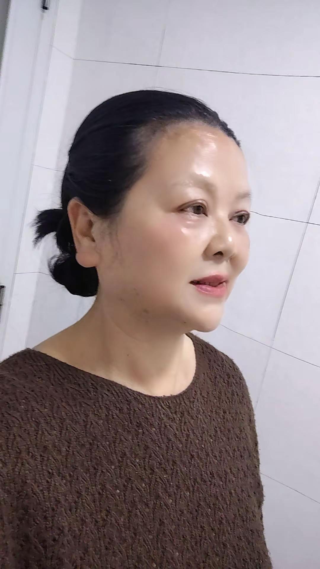 晒出你的双眼皮