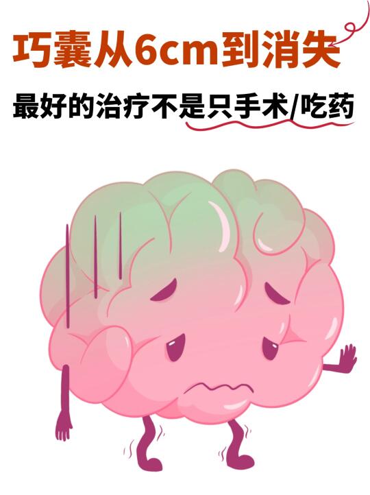 巧囊6cm到消失，最好的治疗不是只手术/吃药