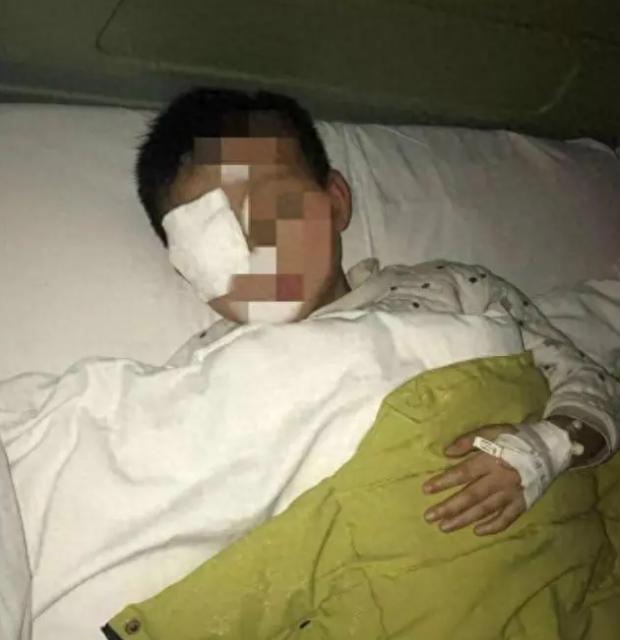 仅仅20分钟，8岁男童眼球就被熔化，终生失明，这个看似无害的小物件,家家户户都有