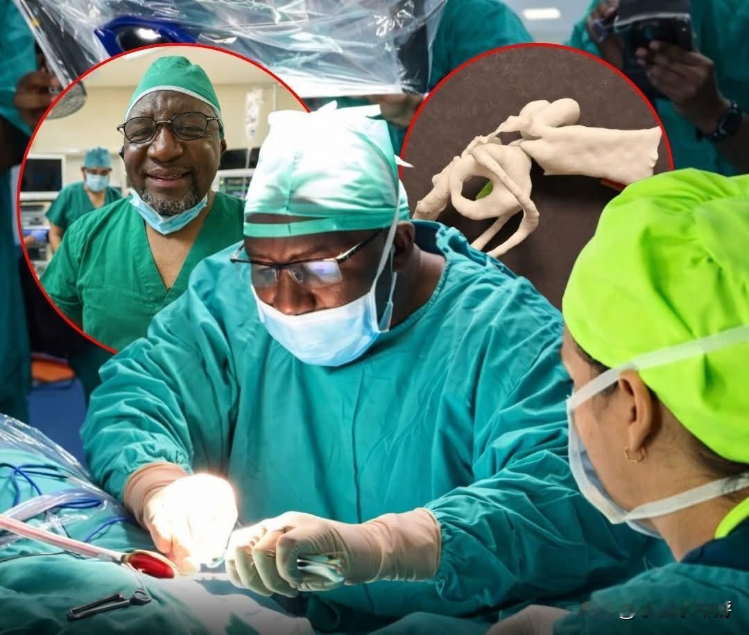 一名南非医生利用3D打印耳骨帮助一名男子恢复听力，创造了历史。该手术替换了受损的