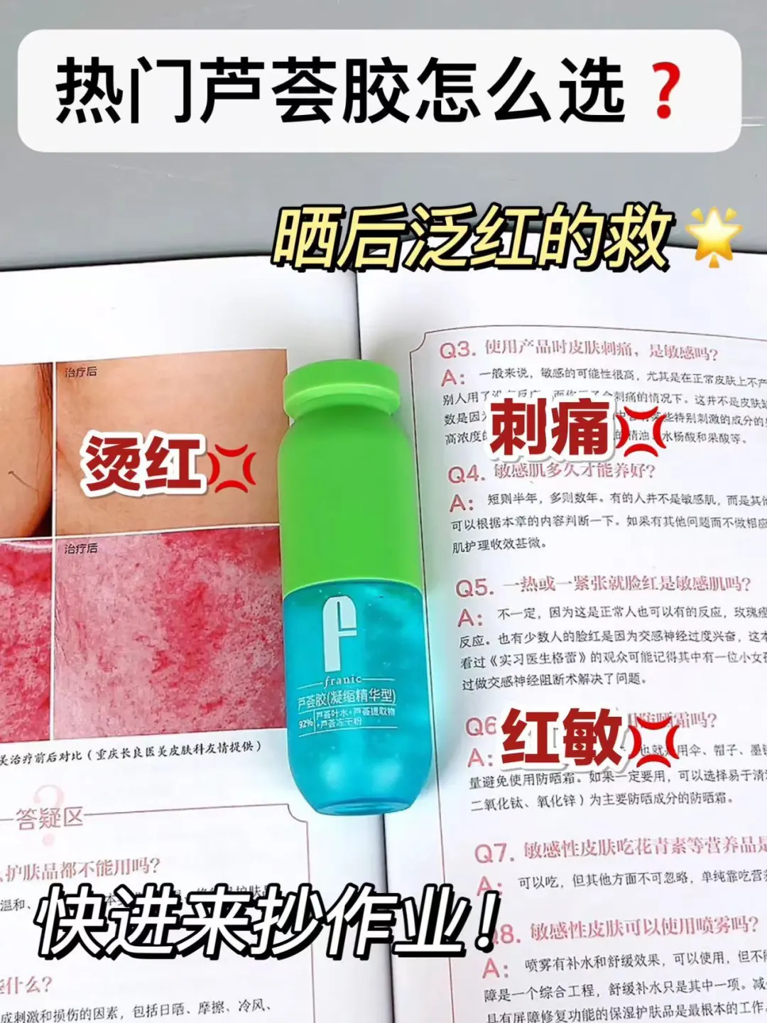 芦荟胶选购攻略！行走的晒伤脸“灭火器”！