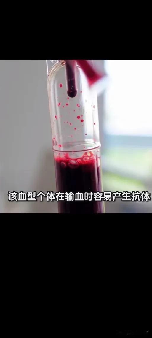广东顺德惊现“钻石血”！比熊猫血罕见百倍，全国都难寻，背后故事更揪心
 
“活了
