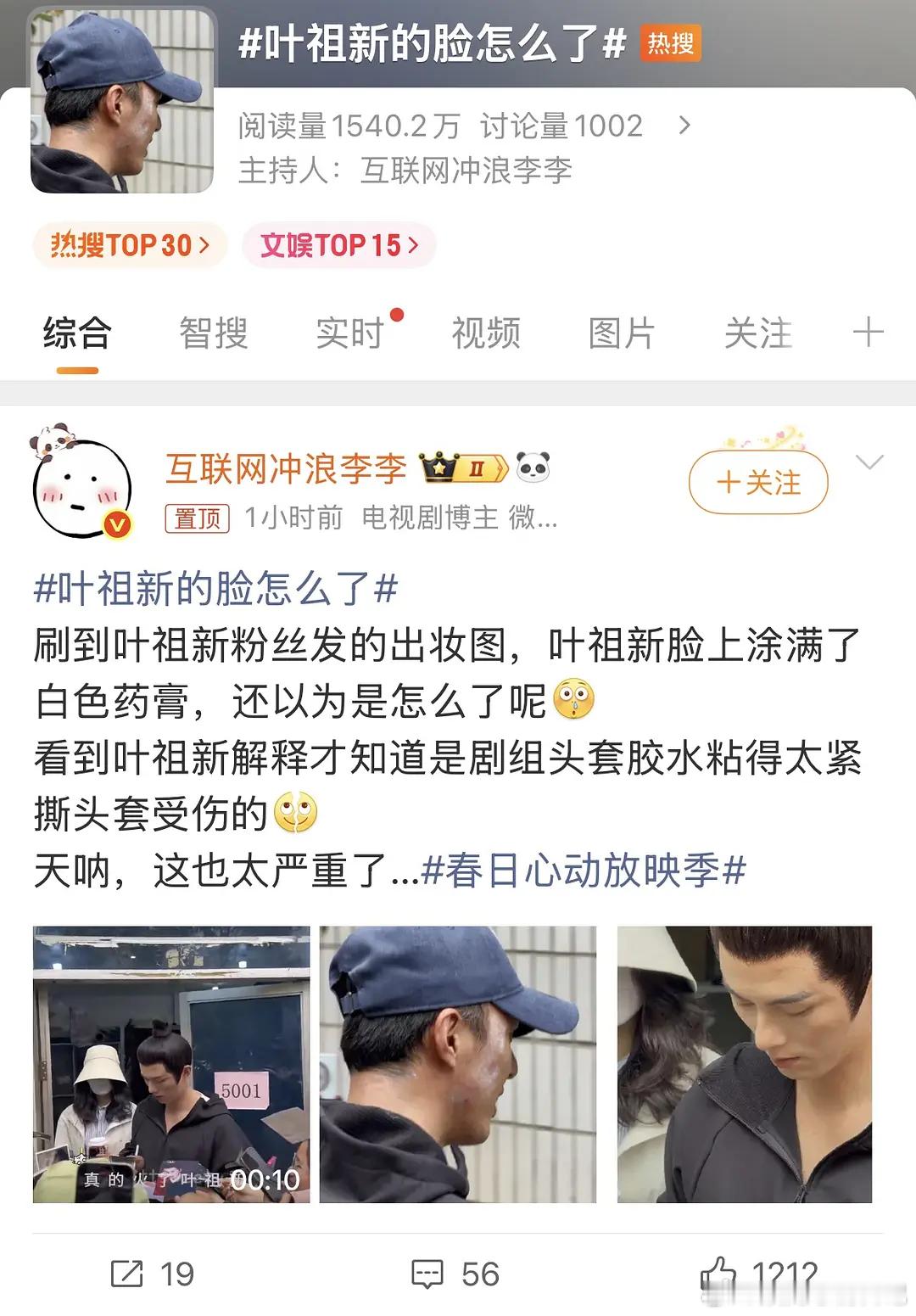 哪个剧组扣成这样，给演员用点好的头套胶水不行吗亏的叶还解释说撕的，那是叶哥人好，