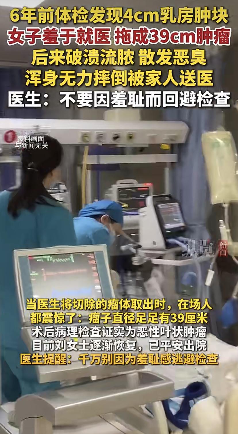 乳房摸到个疙瘩，不好意思看医生，结果差点没命!39厘米肿瘤太吓人
"6年前就发现